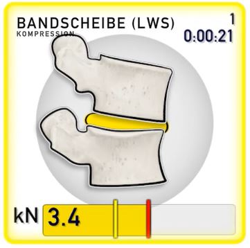 Bandscheibenkompression Armlagerung Nordiska