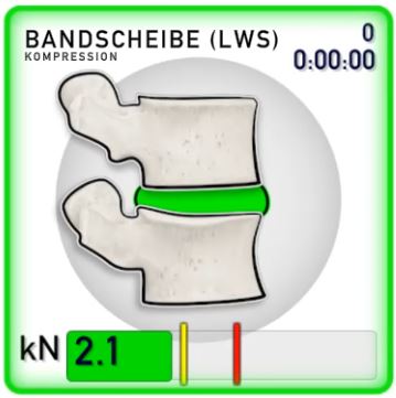 Bandscheibenkompression mit MATS