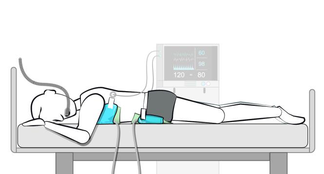 Inflatable Prone Ventilation (Einweg)  L - Bild 1