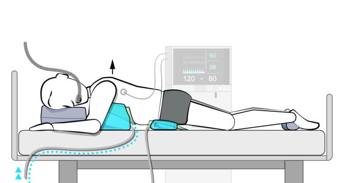 Inflatable Prone Ventilation (Einweg)  L - Bild 1