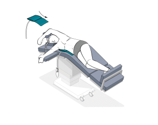 Mini-Wedge